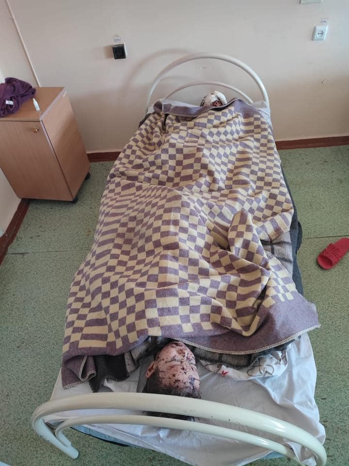 Русский мир такий: Сєверодончанка та двоє її дітей-близнюків постраждали внаслідок обстрілів військ РФ 04
