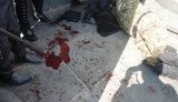 вр провокации под раненые