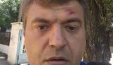 Поліція почала кримінальне провадження за фактом побиття в Херсоні журналіста Нікітенка