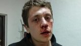 С14 вибачилися за побиття активістів у Дніпрі: "конфлікт стався без відома керівництва руху"