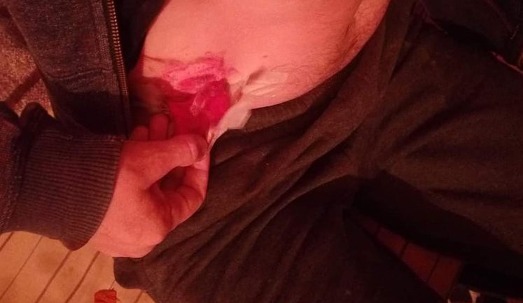 Бунт в СИЗО Кропивницкого: к 25 заключенным применили спецсредства. ФОТОрепортаж