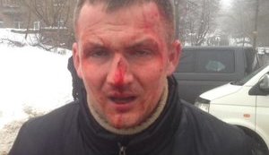 Поліція з'ясовує обставини побиття нардепа Левченка
