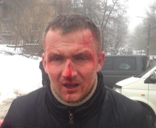Нардепа Левченка побили в Києві, - депутат Київради Кутняк 01