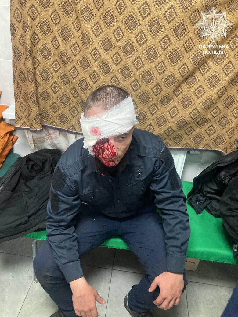 В Запорожье российская ракета взорвалась возле полицейского авто: 4 патрульных ранены 02 В Запорожье российская ракета взорвалась возле полицейского авто: 4 патрульных ранены 02