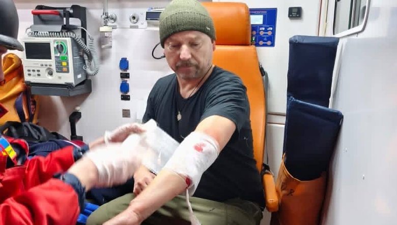 поранений журналіст