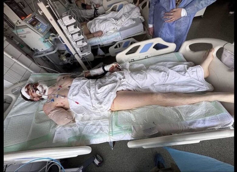 На початку лютого Медвідь отримав важкі поранення: він втратив праву руку, пошкоджено зір…
