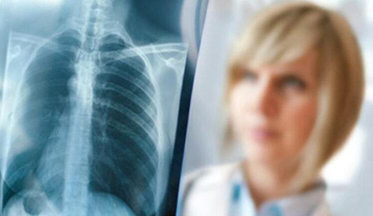 Ukraine ranks second in Europe in terms of tuberculosis incidence, Acting Health Minister Suprun says