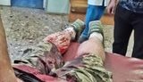 Громадянину РФ заочно повідомили про підозру в організації нападу на ветерана АТО Вербича в Києві, - прокуратура