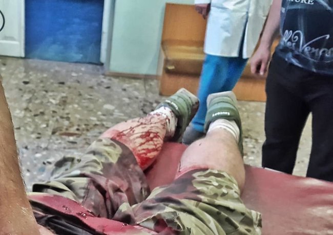 Замах на життя кіборга Дмитра Вербича: вирішили покарати бандерівця 01
